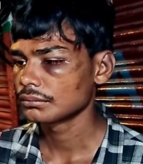 Muslim_ITCell's tweet photo. Nashik route, Sept 18, Fadnavis's Maharashtra.

A Muslim youth Imran Sheikh, travelling from Mumbai towards Uttar Pradesh, has alleged that a group of men assaulted him on a train after it crossed Kalyan.

Imran Shaikh says the men tried to snatch his chain, tore his shirt and used it to tie him, beat him, and forced him to chant “Jai Shri Ram.” He also claims railway police refused to register his complaint. #IndianMuslims