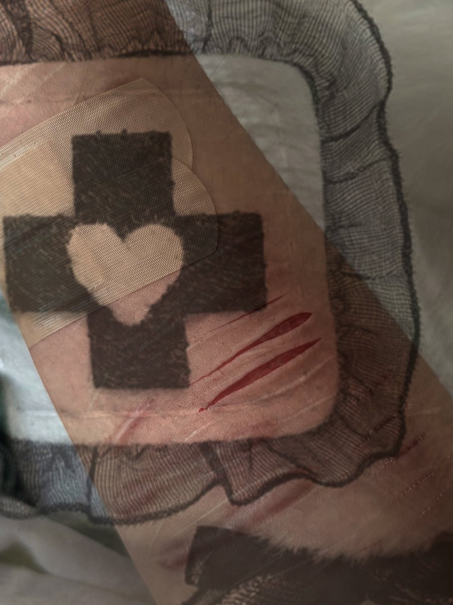 I4ndmine's tweet photo. how am i gonna cover this up properly without bandages i’m so stupid
.
.
.
sfx makeup, all fake https://t.co/cYZHIAwi6L