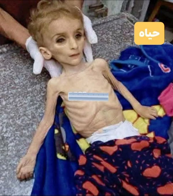 IbrahimHuda12's tweet photo. تحدّثوا عن الجوع… 

قبل أن يموت أطفال غزة من الجوع جميعا.... https://t.co/H0ZtNDicJj