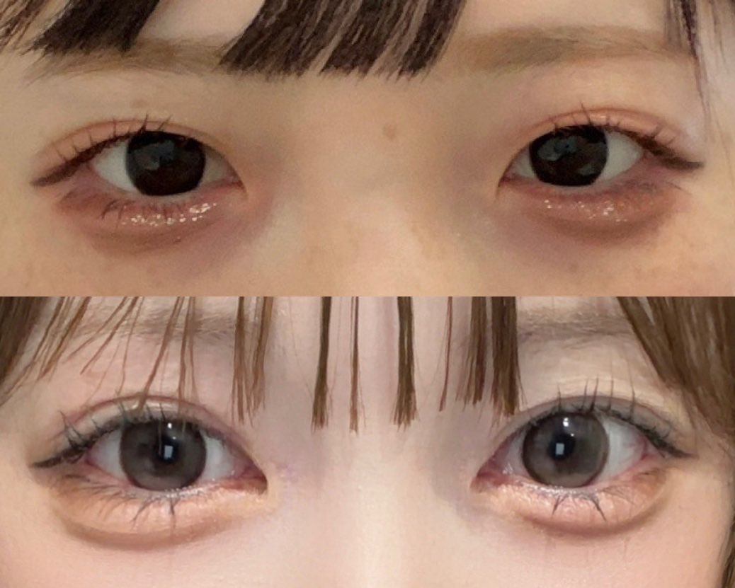 kanikanitakocha's tweet photo. 目フル＋額挙上で神になった૮₍ ඉ́  ̫ ඉ̀ ₎ა🩵 https://t.co/YAO5r8YM1l