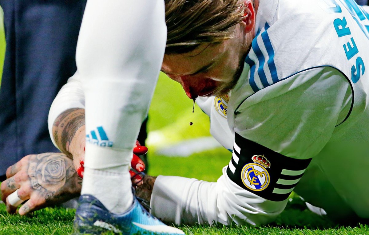 a9314406's tweet photo. sergio ramos sustains a blood nose 🩹🩸, 181117 #DailySergioRamos https://t.co/SVNGgY5f1U