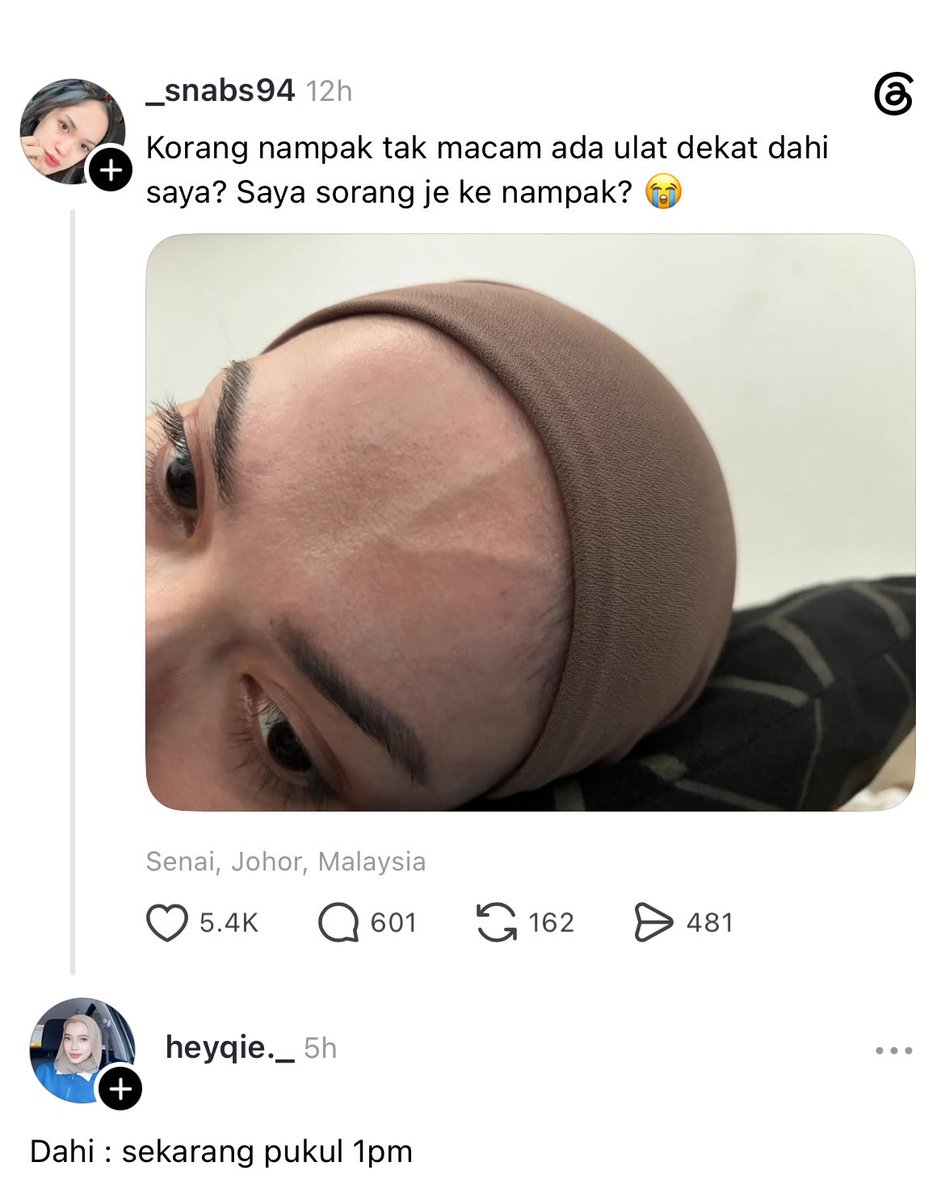 localrkyt's tweet photo. 😂 https://t.co/YOYFaRMjr1
