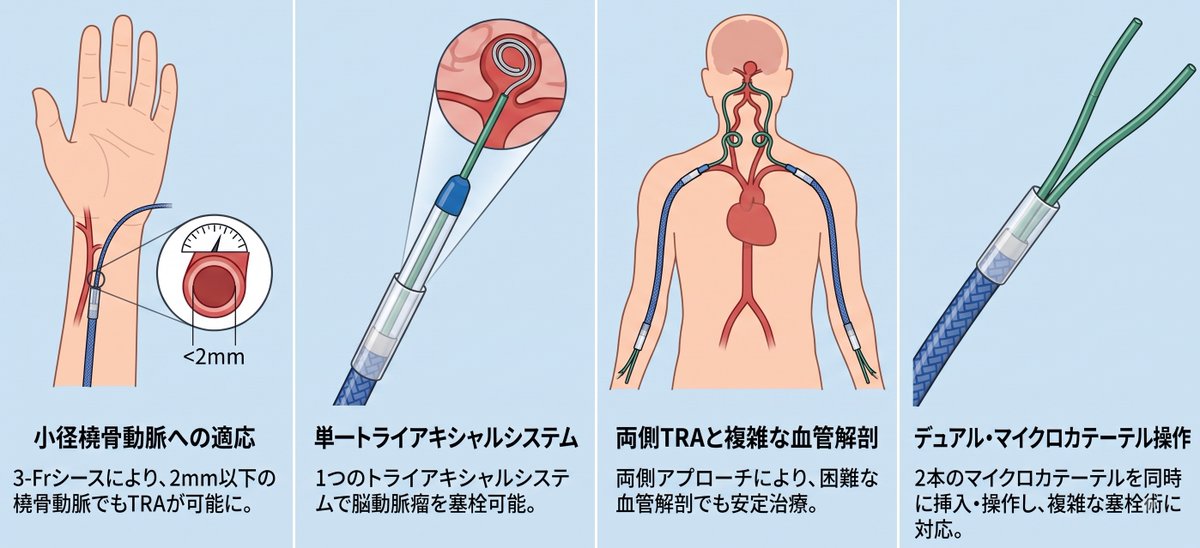 YNMSiFVLnNqoSMe's tweet photo. 3-Frガイディングシース(Axcelguide; Medikit, 日本)の橈骨動脈アプローチ(TRA)の脳動脈瘤塞栓術
体外検証で、3-Fr内に2本のマイクロカテ(Headway Duo)が同時挿入可能💉日本製のカテーテル⚕️
Interv Neuroradiol 2026 32(3) 1125–
#Axcelguide #Medikit https://t.co/1uBLgcmIP7