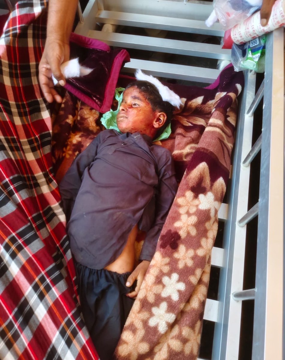 sakhtarmengal's tweet photo. I appreciate this gesture and believe peace and dialogue are the only way forward. But yesterday, in my own village, a child was shot while families were preparing for a wedding. If this was “a mistake,” is that really enough? Is a child’s life so easily dismissed? Peace cannot mean silence, and dialogue cannot exist without accountability