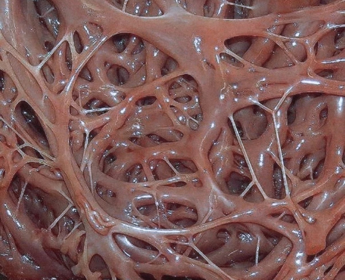 moriitician's tweet photo. trabecular muscles of the heart. •˚꩜｡ https://t.co/zEEOKITw8i