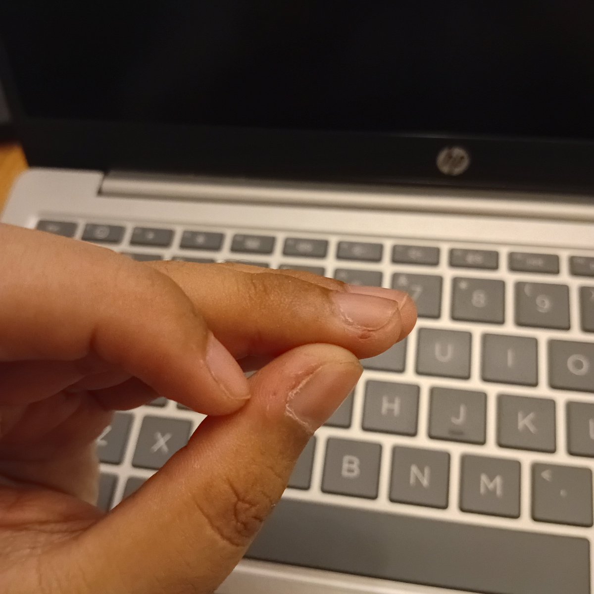 _ayreshome's tweet photo. kepala berisik dan kulit jari yang (selalu) terkopek https://t.co/hkVLDgeJl0