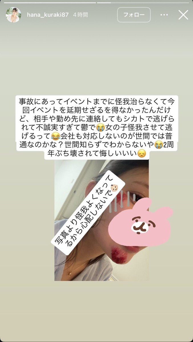 ori_newsroom2's tweet photo. 【訃報】
有名セクシー女優の倉木華さんが先日、エルコレの平良翔太さんの借りていたマンションで首を吊った状態で発見され、亡くなりました。

第一発見者はとある有名ホストです。

倉木華さんが平良翔太の車（マイバッハ）に乗ろうとしたところを急発進され、顔に���怪我をした件や、LINEのやりとり、倉木華さんを脅していた証拠やその他エルコレとの示談書など様々な証拠が届いている為、すべて公開します。

また、今回の件はスカウト、ホスト、海外出稼ぎ、暴力団のかなり深い闇に触れます。
エルコレというホストグループがどれだけ危ない場所か皆さんにその一端を公開致します。

投稿を見た方は絶対に海外出稼ぎや暴力団、エルコレというホストグループがどれだけ危ないものなのかをよく考えて戴きたいと思っています。