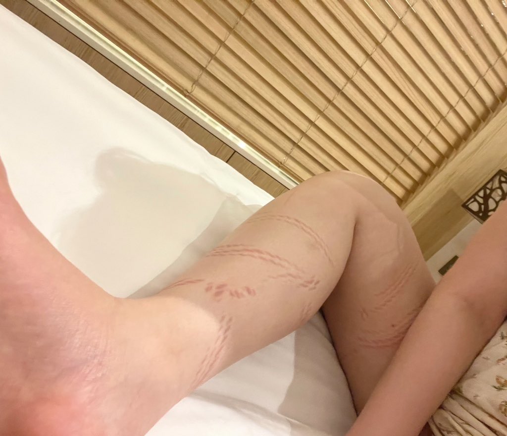 Jelly_from_Hell's tweet photo. 묶묶 자국 행복해요𐔌՞ ܸ.ˬ.ܸ՞𐦯♡ https://t.co/anHGkzZm69