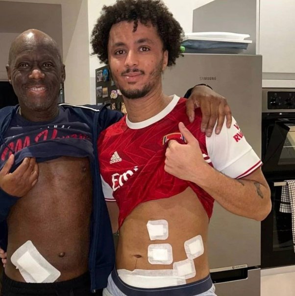 web3bj's tweet photo. A son saved his father's life twice, first by donating bone marrow to help him beat cancer, then years later by donating one of his kidneys after he developed chronic kidney disease. https://t.co/BtnOWgsok3