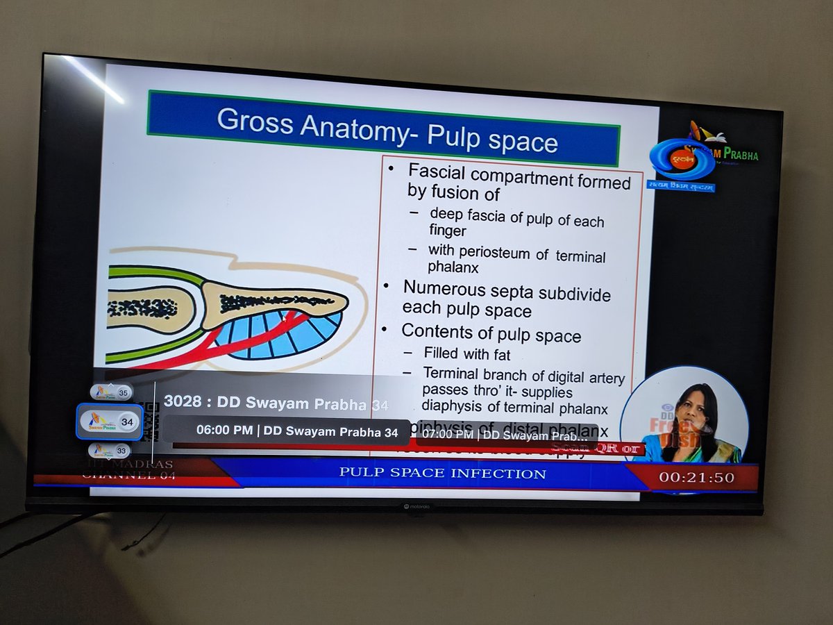 DrAshishPradhan's tweet photo. Today I learnt that Doordarshan has a dedicated channel for medical students.

DD Swayamprabha 34 https://t.co/0tGeXbO8uG
