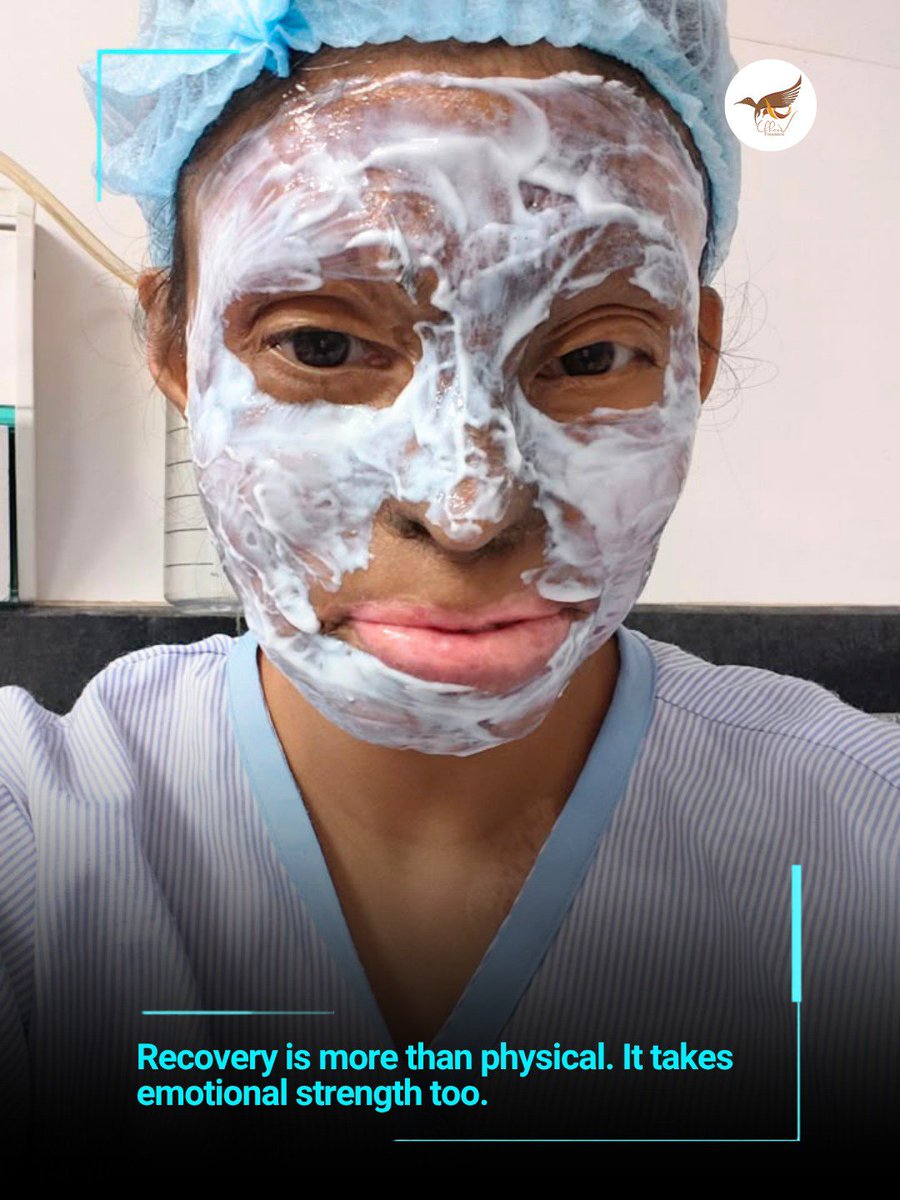 StopAcidAttacks's tweet photo. Today, our Sheroes underwent another laser surgery as part of their ongoing skin reconstruction and healing journey, under the supervision of Dr. Shivangi Saha.

Every procedure is a step forward in a long and challenging journey of healing from acid violence. The process is not limited to physical recovery. It also takes immense emotional and mental strength to keep moving forward, one procedure at a time.

This is not a one-day process. Several more surgeries are still needed, and every step demands patience, courage and determination. Yet, our Sheroes continue to show up, face each challenge and choose hope, even on the hardest days.

Their scars are a testament to survival. Their resilience is a reflection of their strength. And their journeys remind us why the fight against acid violence must continue.

At Chhanv Foundation, we stand with our Sheroes today and always, supporting them through every step of their healing and working towards a future where no one has to endure the cruelty of acid violence.