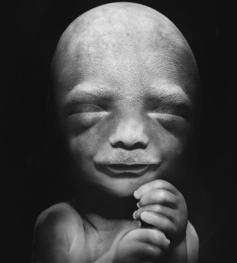 KristanHawkins's tweet photo. This is your reminder that abortion supporters think it's okay to kill this baby. https://t.co/oEgdW4vpnj