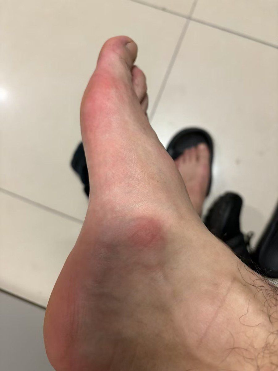 0b31t's tweet photo. 这鞋好挤啊服了我的脚😭 https://t.co/XAMP8a6fSY
