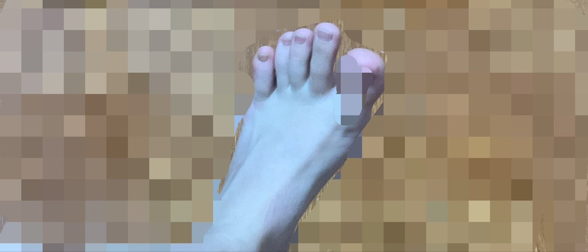 dlixzeA's tweet photo. 🦶 x2 https://t.co/3xPOBDZLSR
