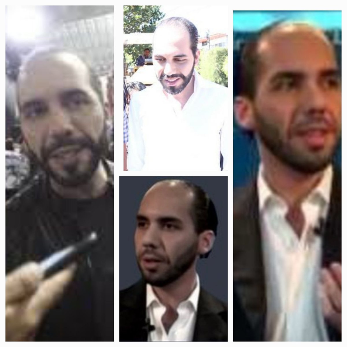 amadeo1980's tweet photo. Ni pisto para un simple injerto de pelo tenía , pero las focas comecuanday dicen: "Es millonario desde la cuna" . https://t.co/5BtFbZLqzr