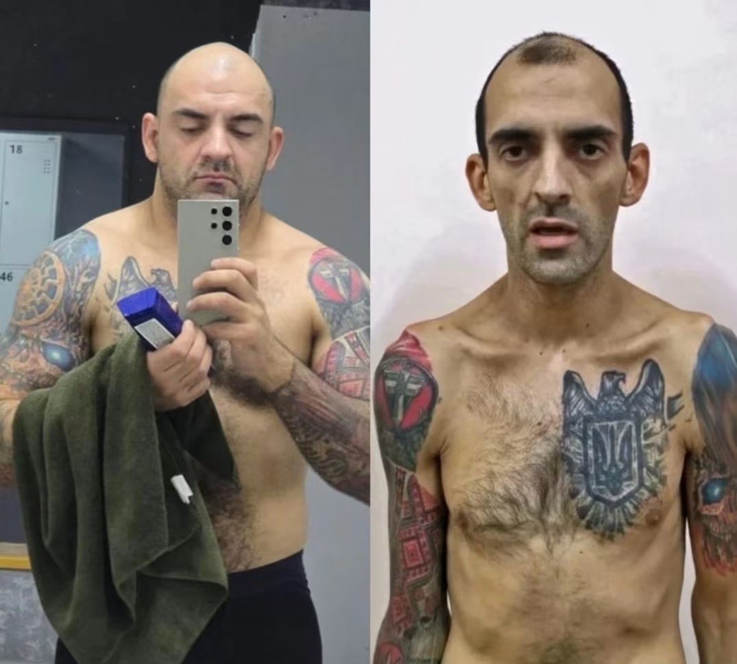 rshereme's tweet photo. His teeth were pulled out with pliers, and the second time – simply knocked out.

And this is not even the most horrifying thing he described.

Imagine a man who weighed 95 kilograms – 209 pounds.

And then dropped to 59 kilograms – 130 pounds.

Not because he lost weight – but because this is how he was "kept."

This is Yevhen Chudnetsov. An Azov fighter. A man who was in Russian captivity twice – and survived.

The first time, he was captured in Shyrokyne. From February 2015 until December 2017. Almost three years.

After the exchange, he returned to his unit.

Then – Mariupol. Then – Azovstal.

And captivity again.

He was released only in May 2023.

He speaks about rehabilitation calmly, almost matter-of-factly:

"I barely went through rehabilitation. For me, the best rehabilitation is to return to my duties. Because the war won't win itself."

And now – the part that makes your blood run cold.

The first time, his teeth were pulled out with pliers.

The second time – they were simply knocked out.

The drastic weight loss caused hormonal problems.

A broken arm. A broken leg. Nine broken ribs.

And scars on his arms and legs – from the handcuffs they used to suspend him.

He was in Olenivka.

Not in the barracks where the explosion happened – in the one next to it.

He remembers several explosions.

At first, they thought the administrative building had been hit. But when the fire started, from the second floor they could see: it was the industrial zone.

That same barracks.

The explosion was so powerful that pieces of roofing flew all the way to them.

Chudnetsov says a thermobaric charge was used inside. He believes it was no accident.

It was a demonstrative execution.

Medical assistance – zero.

On the guards' faces – not a trace of surprise.

They knew.

Our men begged them to let the combat medics out.

They refused.

Only an hour to an hour and a half later did they allow medics from the 55th hospital to come out.

The ambulances arrived toward morning.

When there was almost no point in coming anymore.

The treatment of Azov fighters was different.

They received three times more beatings than everyone else.

And Azov medics – even more.

The reason?

Propaganda.

The Russians invent their own stories – and then believe them themselves.

There is almost no information in captivity.

The only "truth" is whatever the interrogator or the FSB decides to tell you.

If he is in a good mood – he tells you something.

If he is in a bad mood – he says nothing.

Whether it is true or a lie – you have no way of knowing.

He learned about the exchange on the day of the exchange.

An hour before it happened – interrogation, protocols they did not even allow him to read.

During the night, they began opening cells and calling out names.

When they opened his – he heard his name.

The road home: plane, bus.

And the fear of allowing yourself to be happy.

Because this could have been not an exchange, but simply another prison transfer.

He thought he would be there for at least three years.

And still, he does not consider himself a hero.

He simply returned to do his job.

"The war won't win itself," he says.

Five words from a man who was tortured twice.

Read them again.

Because while someone says they are "tired of the war," this man, without his teeth and with broken ribs, returned to service.

He is not tired.

And we, all the more, have no right to be.

Source: translated from the text by Bairak Oleh