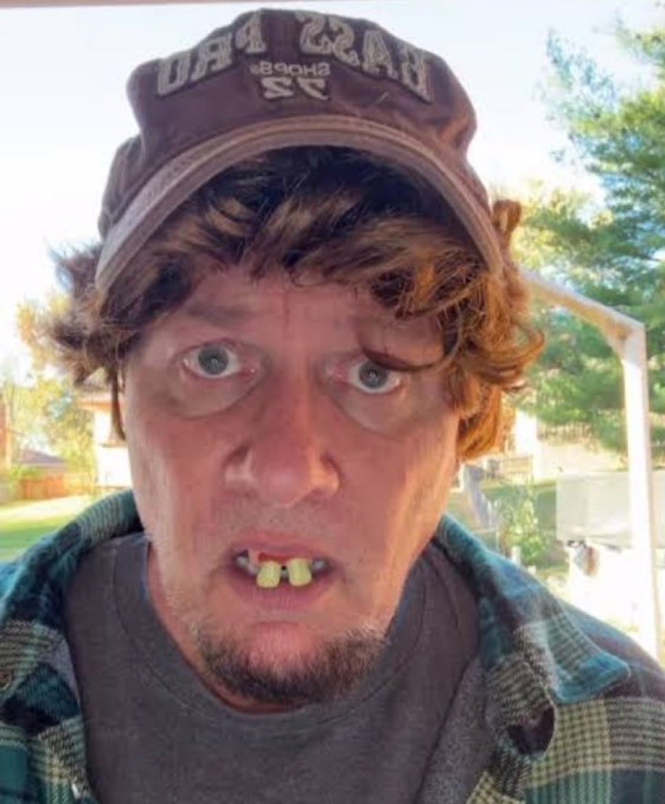 Caizak7's tweet photo. @channelingitt @watsupfolk @AceRod13 @CosmosEnjoyer25 @ApexMetal Perfectly normal head I’ve got 🤣

But I forgot that white people don’t have ugly individuals, it’s only Somalis who have ugly people who you generalize the whole group with. Somalis are one of the best looking people on average, stop falling for propaganda https://t.co/BeW5Ix6LMo