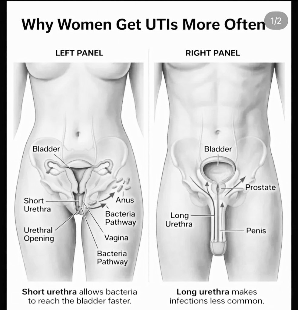 Healthylife_HQ's tweet photo. Why women get UTI's more often than men: https://t.co/GR6MkwH68B