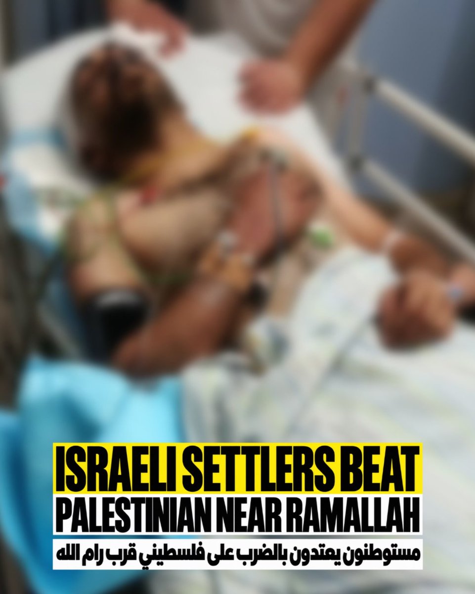 EyeonPalestine's tweet photo. The young Palestinian man, Mohammed Abu Radwan, was injured after Israeli settlers severely beat him on land belonging to the village of Beitillu, west of Ramallah. https://t.co/oN1tpuAZeb