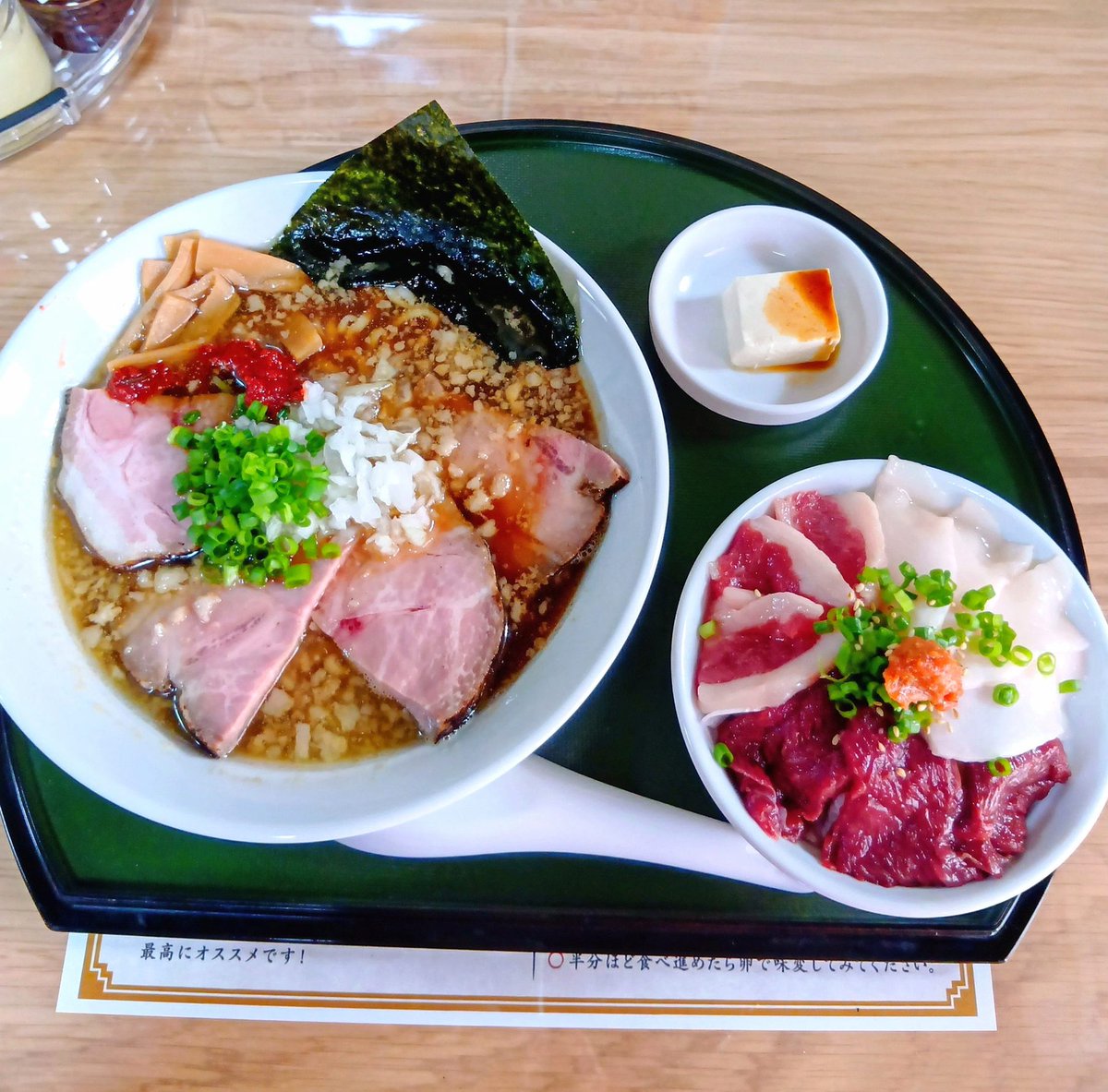 Vishvam39's tweet photo. 歯医者で初めて麻酔したんだけど、口の左側マージで感覚ない。なんかすごい不思議な感覚でちょっと楽しい笑 https://t.co/PmMVmecR83