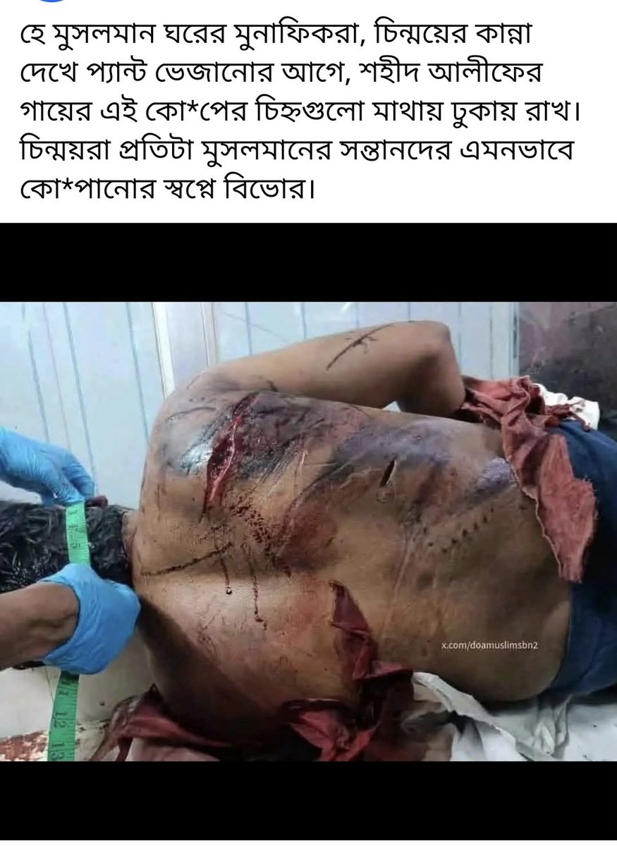 Hasan02091989's tweet photo. @MrHridoy00755 হিন্দু জংগী সংস্থা সদস্যদের কে দেখা মাত্রই এই অবস্থা করে দেয়া উচিত। https://t.co/rrHXth7Dfn