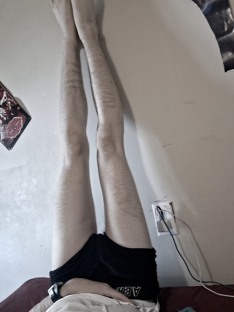 WingsHaveRot's tweet photo. My legs are so swollen today. I NEED to be in the bmi 14s before October #edrtwt #shed #shedrtwt #ricecakerwt #bc #bodycheck https://t.co/SclwUdTh5w