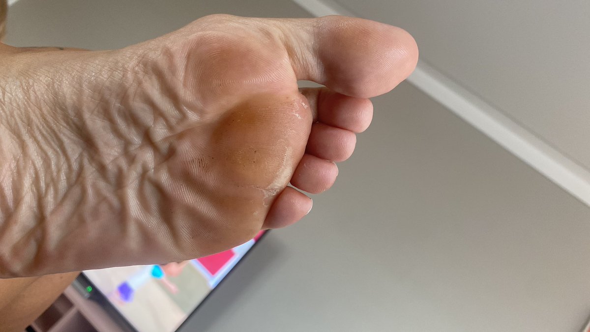 paypariss's tweet photo. This dry skin is getting out of control. Whose teeth am I using as a foot file? https://t.co/ObgpvCSLmy