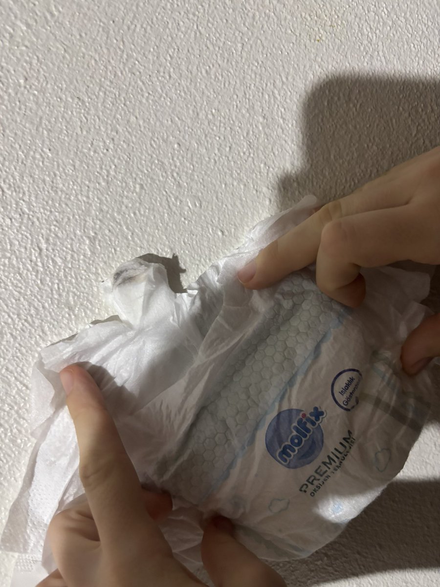 erhntuna's tweet photo. Aldığımız molfix içinden katılaşmış siyah lekeli nonwoven parçası çıktı. Ürünü yenidoğan bebeğimiz için kullandığımızdan bu durum bizim için ciddi bir güvenlik ve hijyen endişesi oluşturmuştur. Yabancı maddenin bebeğimizin cildine temas etmesi kabul edilemez bir durumdur. @molfix https://t.co/SomFyYJs8T