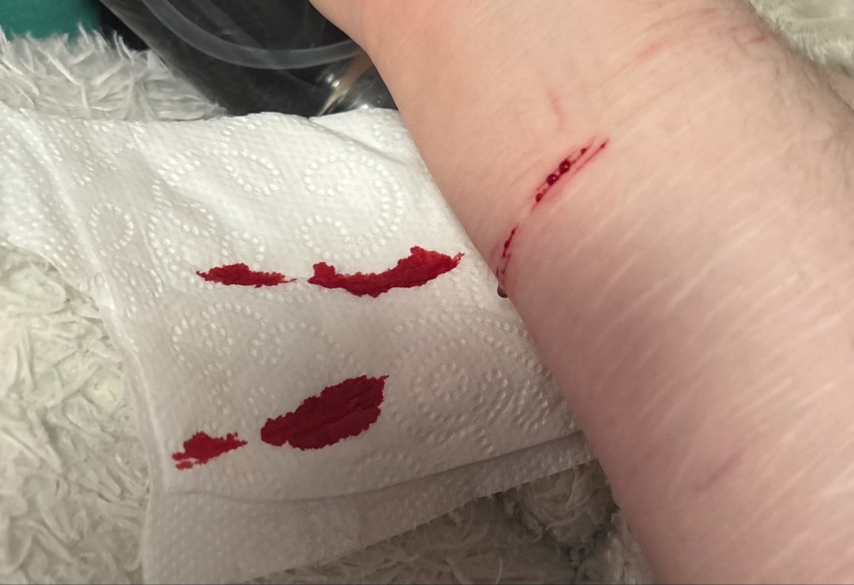 rottting11's tweet photo. this much blood AND MORE for these six little things😭 SFX MAKE UP! THIS IS FOR HALLOWEEN! ALL FAKE!!
#slittwt #shedrtwt #shrtwt #sfx #sfxmakeup #ouchietwt #redink https://t.co/YQG4GW9fa3