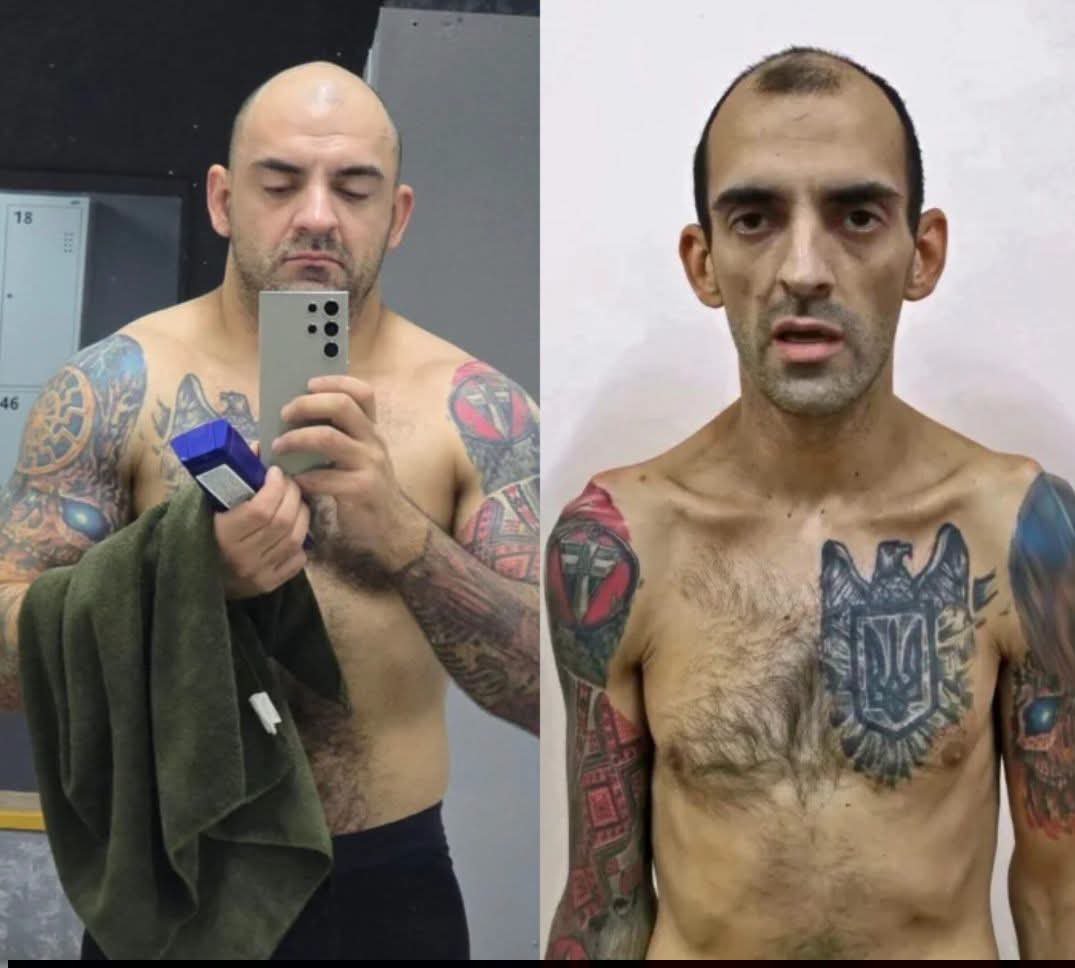 Oct7NeverForget's tweet photo. THE FIRST TIME, THEY PULLED HIS TEETH OUT WITH PLIERS. THE SECOND TIME, THEY KNOCKED THEM OUT.

And that is far from the worst thing he survived. This is Yevhen Chudnetsov, an Azov fighter who survived Russian captivity twice. He once weighed 95 kilograms. In captivity, his weight dropped to 59.

The first time he was captured near Shyrokyne. He remained a prisoner from February 2015 until December 2017 — nearly three years. After being exchanged, he returned to his unit. Then came Mariupol, Azovstal — and captivity again. He was finally released in May 2023.

“I barely went through rehabilitation. For me, the best rehabilitation is returning to my duties. Because the war won’t win itself.”

The first time, his teeth were pulled out with pliers. The second time, they were beaten out. Extreme weight loss caused hormonal problems. His arm was broken. His leg was broken. Nine ribs were fractured. He still carries scars on his arms and legs from the shackles used to suspend him.

He was also imprisoned at Olenivka — not in the barracks where the deadly explosion occurred, but in a neighboring building. He remembers several explosions. When the fire started, they could see it was coming from the industrial zone. The blast was powerful enough to send pieces of roofing flying as far as their building.

Chudnetsov says a thermobaric charge detonated inside. In his account, this was no accident — it was a deliberate execution.

Medical assistance was virtually nonexistent. He says the guards showed no surprise. Prisoners begged them to release Ukrainian combat medics to help the wounded. They refused. Only an hour or more later were some medics allowed out. Ambulances arrived toward morning — when for many it was already too late.

According to Chudnetsov, Azov prisoners were treated with particular brutality, and Azov medics even worse. Why? Propaganda. Russia created its own mythology about Azov — and then its captors behaved as though that mythology were reality.

Inside captivity, reliable information barely existed. Prisoners knew only what an investigator or FSB officer decided to tell them. Whether any of it was true, they could never know.

Chudnetsov learned about his release only on the day of the exchange. An hour earlier, he had still been interrogated and handed documents he wasn’t even allowed to read properly. Then, during the night, cell doors began opening and names were called. Eventually, his door opened. His name was called.

Even on the journey home — plane, then bus — he was afraid to celebrate. It might not be an exchange at all, but simply another transfer to another prison. He had expected to remain imprisoned for at least three years.

And yet Chudnetsov does not consider himself a hero. He simply returned to his job.

“The war won’t win itself.”

Five words from a man who survived Russian captivity twice, lost his teeth, suffered broken bones and endured torture. Read them again.

Because while some people say they are “tired of the war,” this man came out of captivity and returned to serve.

He did not quit. We have even less right to.