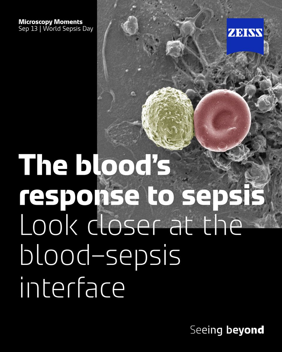 zeiss_micro's tweet photo. On #WorldSepsisDay, let's look closer at the cellular landscape of sepsis research. This SEM image captures red and white blood cells on a layer of platelets in separated blood. The study investigates how human blood reacts to sepsis. Image: Dr Chantelle Venter, @StellenboschUni https://t.co/zLS7SVEFBz