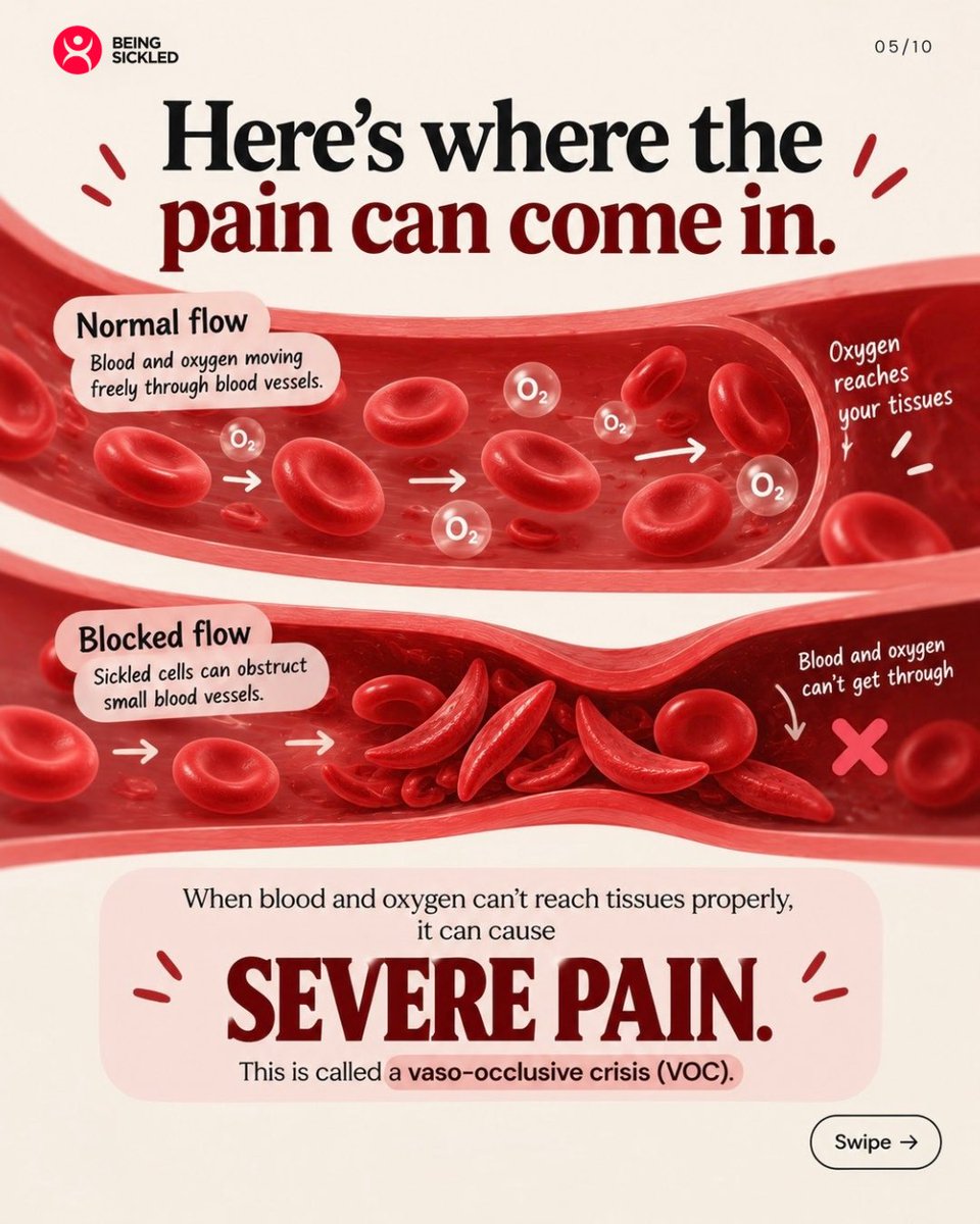 beingsickled's tweet photo. #sicklecellawarenessmonth #beingsickled https://t.co/HLJtqjK91x