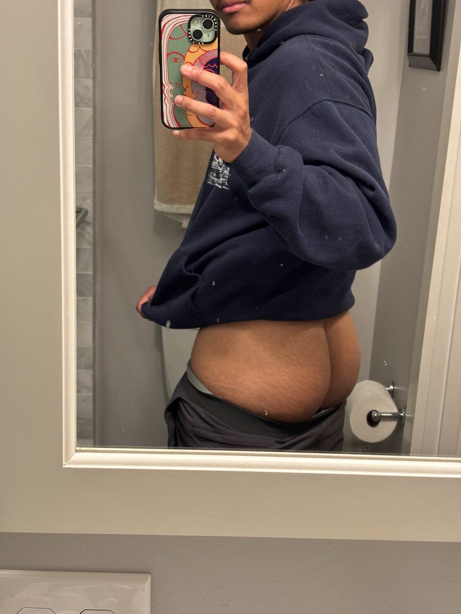 mtigman's tweet photo. do people mind stretch marks? https://t.co/qxv4dWMO8g