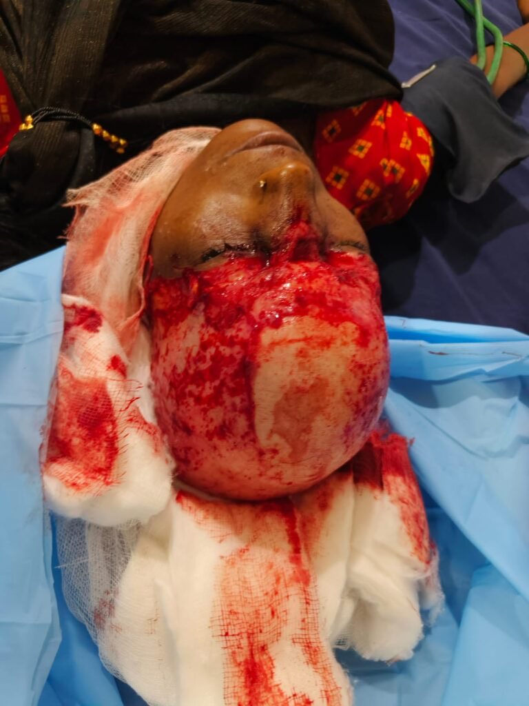 Reddit_Fugitive's tweet photo. Woman scalped by Ferris wheel | India ๐ฎ๐ณ (WARNING: NSFL, Graphic!)
#nsfl #nsfw #accident https://t.co/hm6zCWpEii