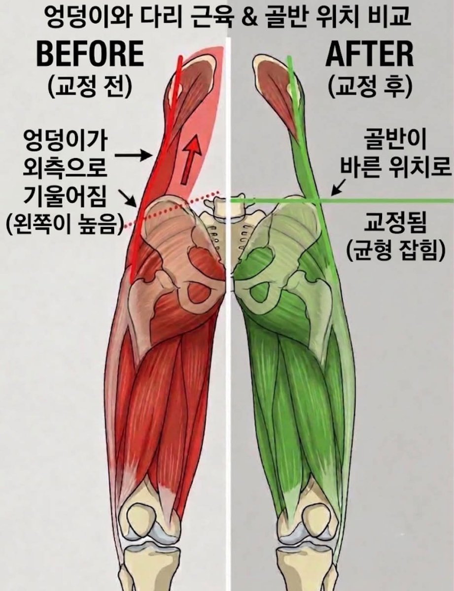 terafabXai's tweet photo. 일본은 진짜 건강에 진심 미친듯,,
나 골반 삐뚤어졌는데
도수쌤이 집에서 이것만 하래ㅋㅋㅋ
2주 동안 계속했는데
골반 교정되고
거북목 나아지고 자세 완전 발레리나 됨;;;;;;; https://t.co/48sqdGD379