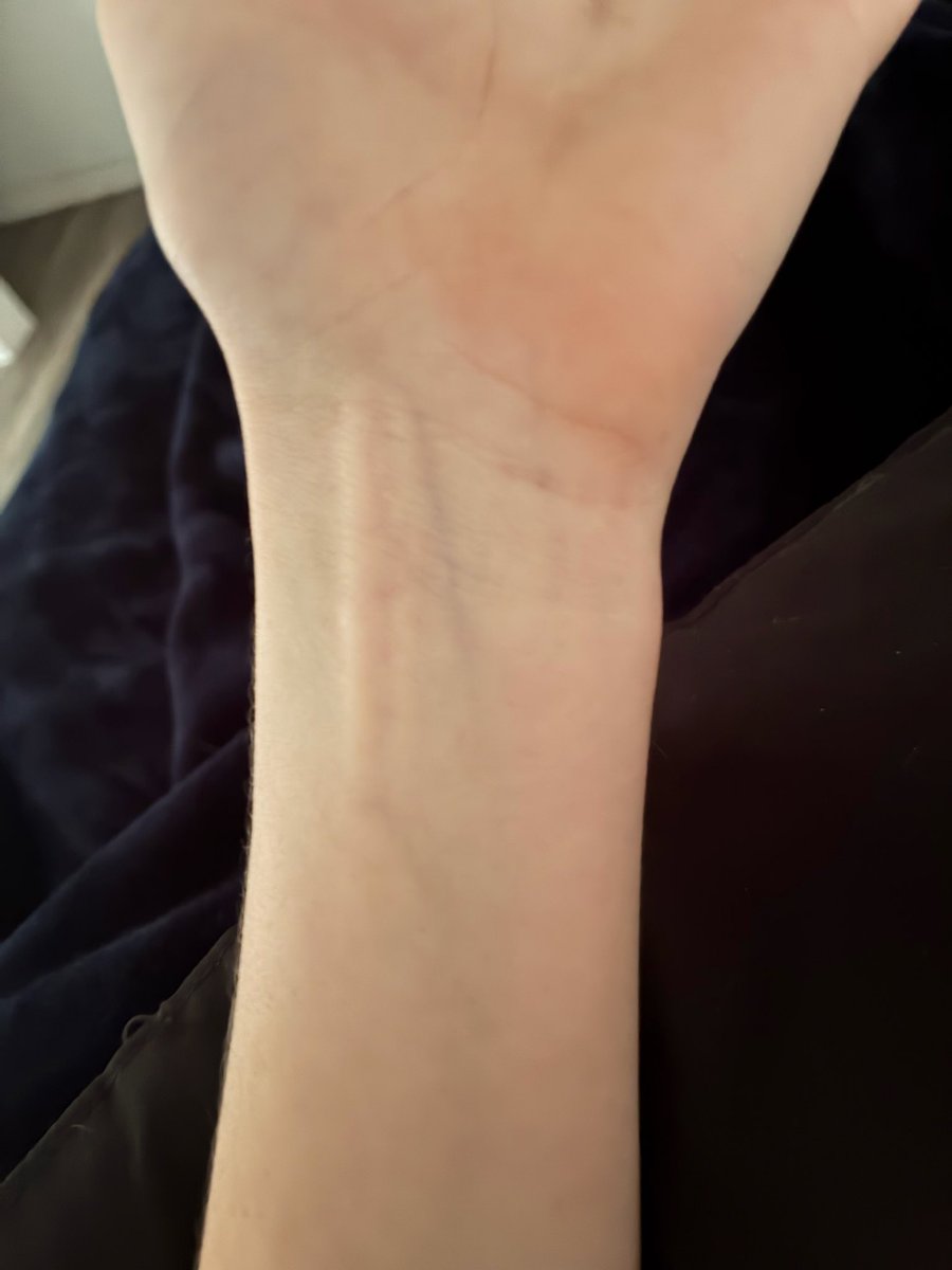 atthec3metary's tweet photo. repost but I love when my wrists look like this idk why but bony wrists make everything better imo 𓏼
𓏼 #edtwtt #shedtwtt #shedtwt #wrist
#cute https://t.co/Y8A4HSOwsY