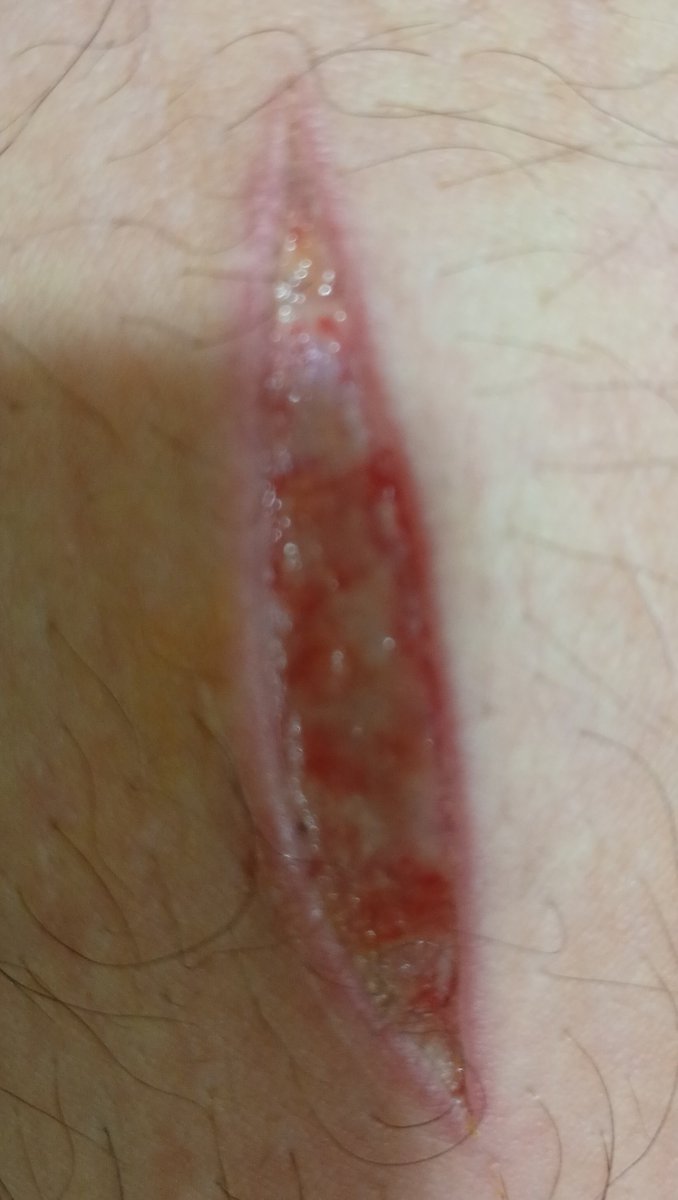 maxiobones's tweet photo. SFX MAKE UP EVERYTHING IS AI

 bean de mierda que me hice por accidente curándose, nunca cuidé tanto un corte 

#shedtwt https://t.co/6FCnN9coqB