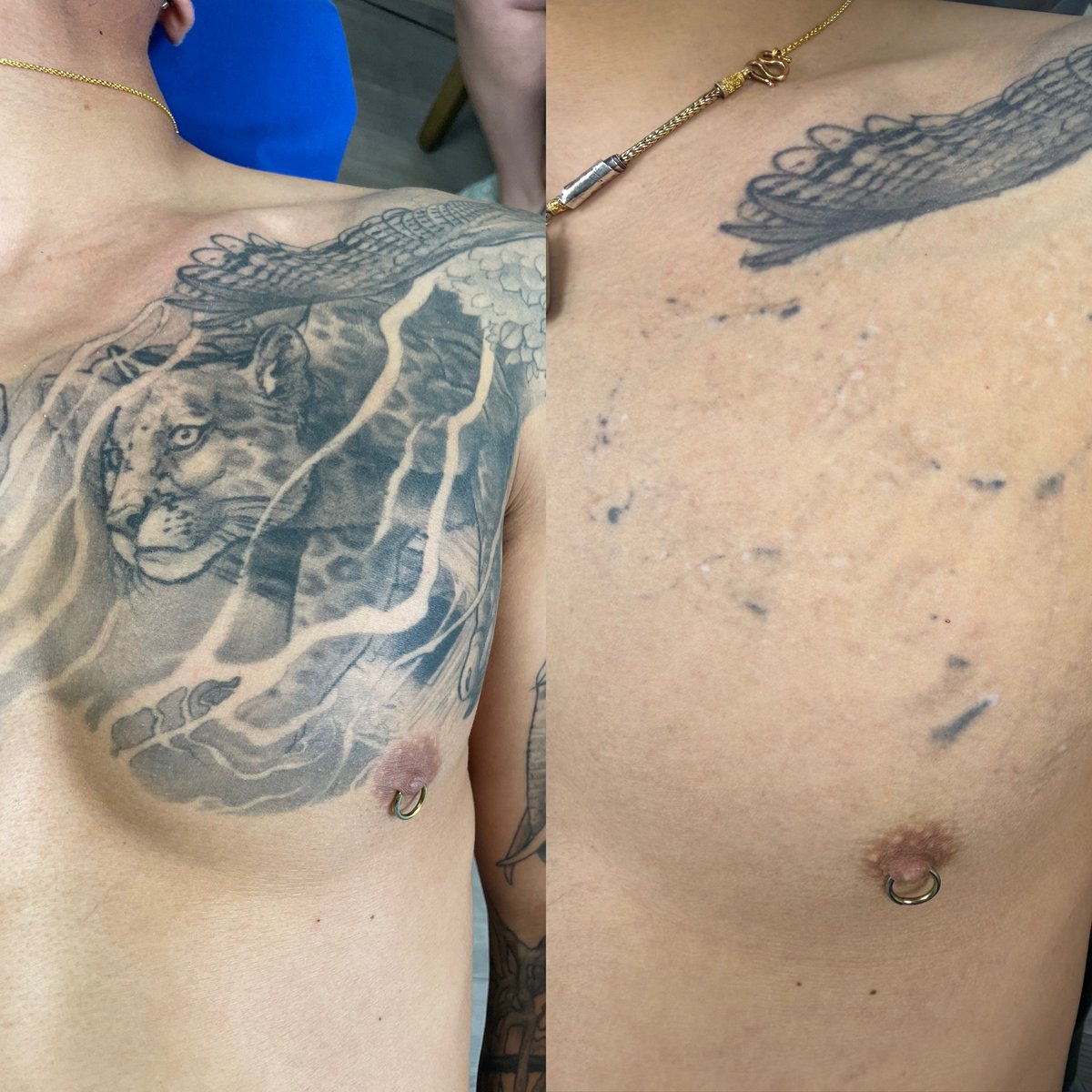 TT_LaserGrl's tweet photo. SIX Treatments #makewisechoices #wisechoice #Denver #colorado #PicoSure #Picosurelaser #picosuretattooremoval #laser #lasertattooremoval #tattooremoval #tattoos #ink #fyp https://t.co/e1uB6yFXVw
