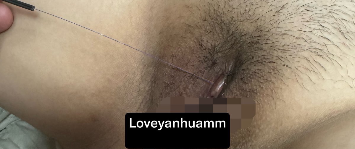 loveYanHuaMM's tweet photo. 之前流西瓜汁的都被x封了。只找到这两张了。后面就是切成小段。然后用钳子扎。西瓜汁。有人知道这是什么扎的吗？#阴蒂责 #调教 #阴蒂 #自慰 https://t.co/fzeBe42dPC
