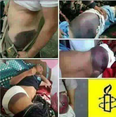 Hmm2Mbb's tweet photo. @Mp_M_Alhazmi @huthaifaabdulah حتى نكون منصفين الاصلاح قدم اعظم التضحيات في الحرب
من منكم مستعد يضحي  مثلهم   وهذا الدليل  على التضحيات  موثق https://t.co/HzXNgZX4NB