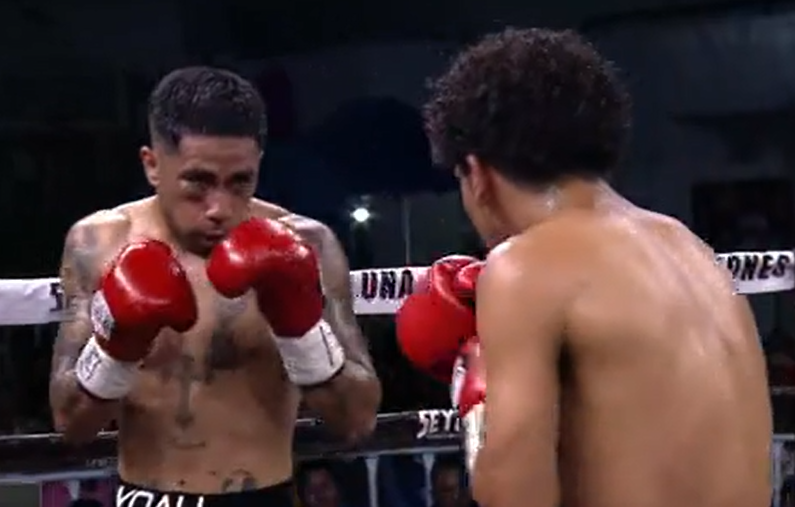 julianisjulius's tweet photo. El destrozo que tiene Yoali Mosqueda en el ojo derecho es por un cabezazo fortuito
#ESPNKnockOut #BXSTRS https://t.co/wazhubUuMK