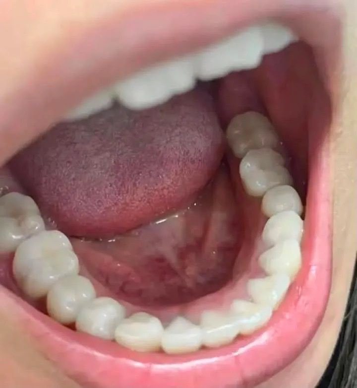 venggk's tweet photo. Saran dokter: ganti pasta gigi dengan Hydroxylapatite.
Hasilnya: plak ogah nempel, karang gigi memudar, napas lebih segar.
Ternyata sesederhana itu. 🥹 https://t.co/mfx8rO4FQj