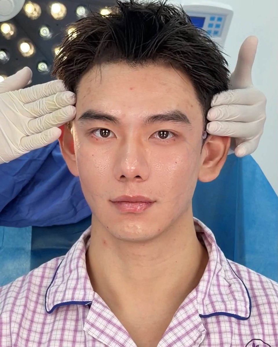 malkymacaulay's tweet photo. This programmer’s transformation was more than just a new hairstyle. Long hours, late nights, and a high-pressure lifestyle had left him looking tired, undefined, and older than he felt. After a detailed consultation, Dr. Xiao created a https://t.co/05edh86Mh1