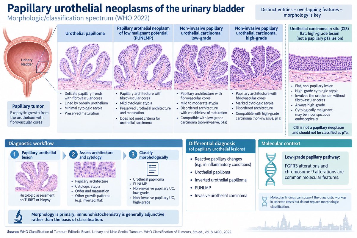 Markuseckstein3's tweet photo. Summary of my below post explaining uropathology for medical experts ! https://t.co/zbBghnvXAx