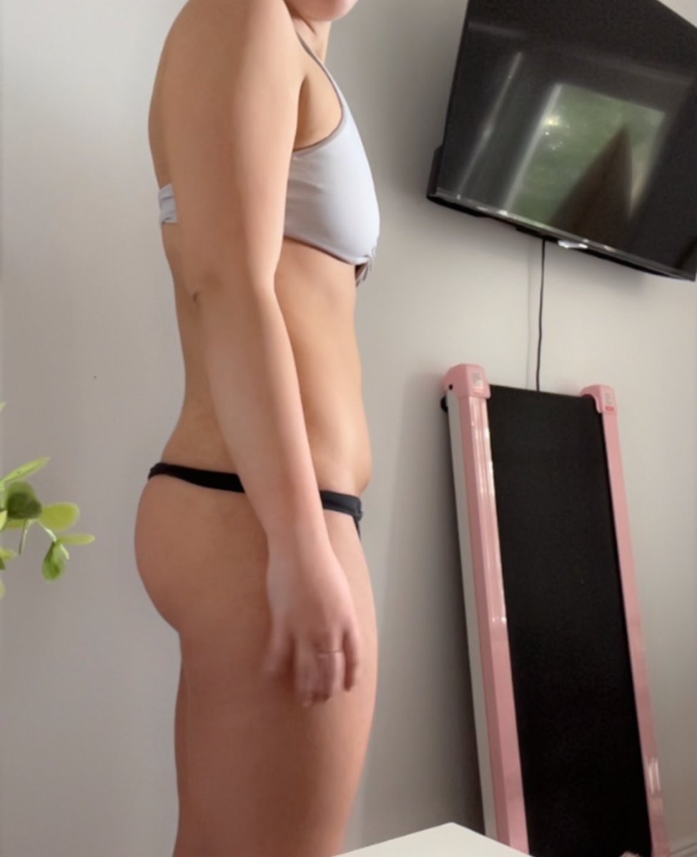 luvcalories's tweet photo. WEEK 3 • 70.9kg
appetite and cravings completely gone. had to force down food at this point to get some energy (not a hardcore rexi like i used to be, gotta keep some of the gains) everything had adjusted nicely and i established a proper routine. https://t.co/eExnGUDft3