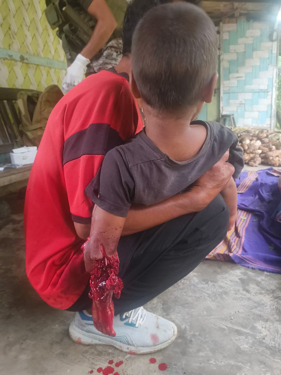 FlorenceGuite_'s tweet photo. 📍L. Tollen, Tamenglong Manipur | 13 Sep2026
To mark the day they brutally massacred hundreds of Kukis, Tangkhul-led NSCN(Muivah) terrorists strike again today brutally killing a woman &amp; injuring her husband &amp; son. See the bleeding hands of this child. @HMOIndia @YKhemchandSingh https://t.co/MSIcUPUdBz