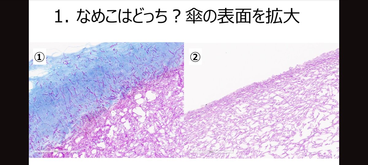 patholounge's tweet photo. ヌメヌメを青く可視化するような染色をして、傘の表面の部分を見ると、どれがなめこかわかるかも！ https://t.co/ud7ZoHmMmu