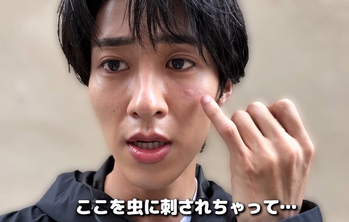 anosa_kiiteyo's tweet photo. 曽野舜太の血ってマジで美味いらしくて、ウチら蚊界隈ではかなり話題になってる https://t.co/Uk5hIPY1U2