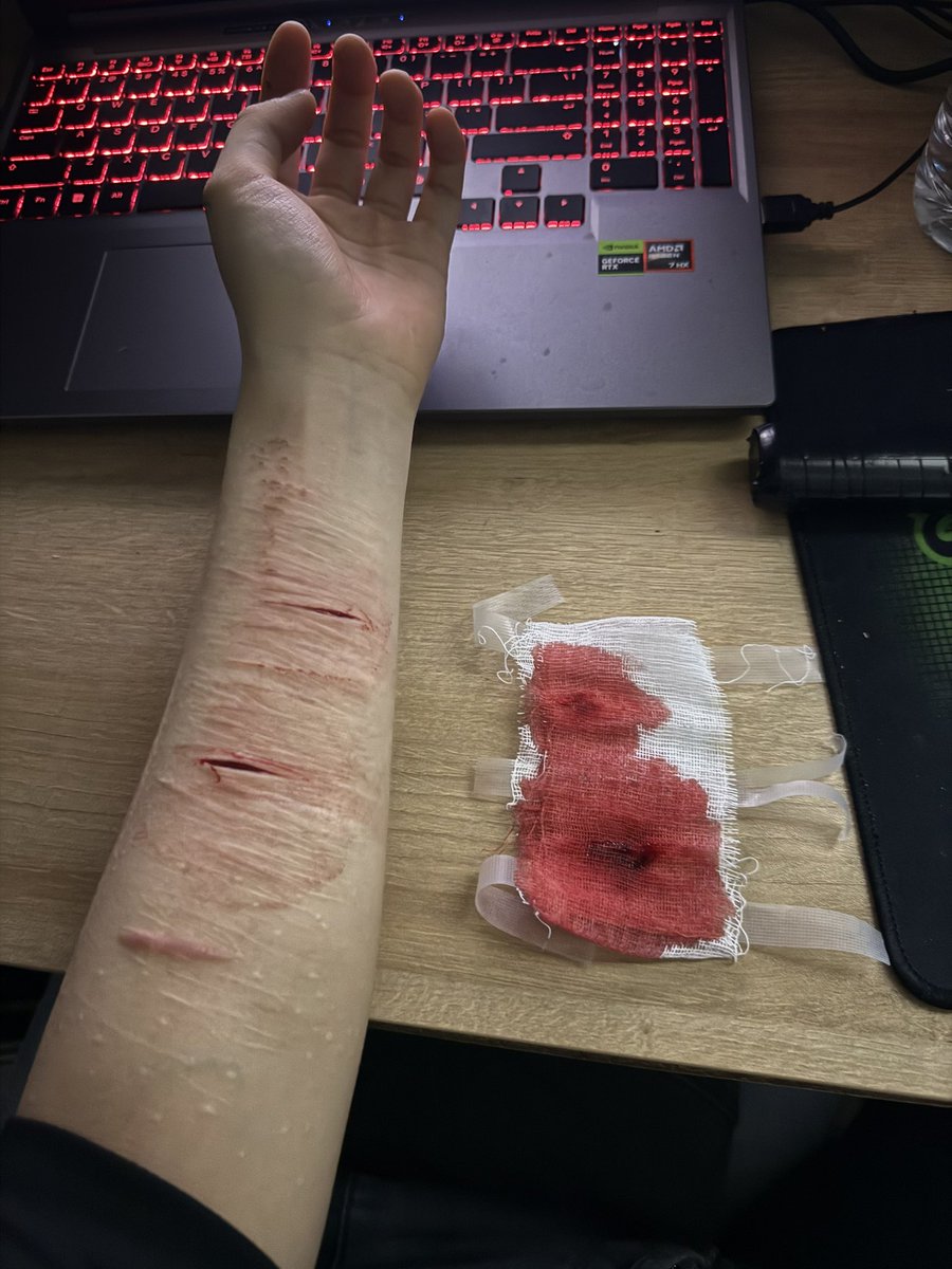 7538612joy's tweet photo. #specialeffect #specialmakeup #makeup #sfx #fake https://t.co/WbZvfksEBN