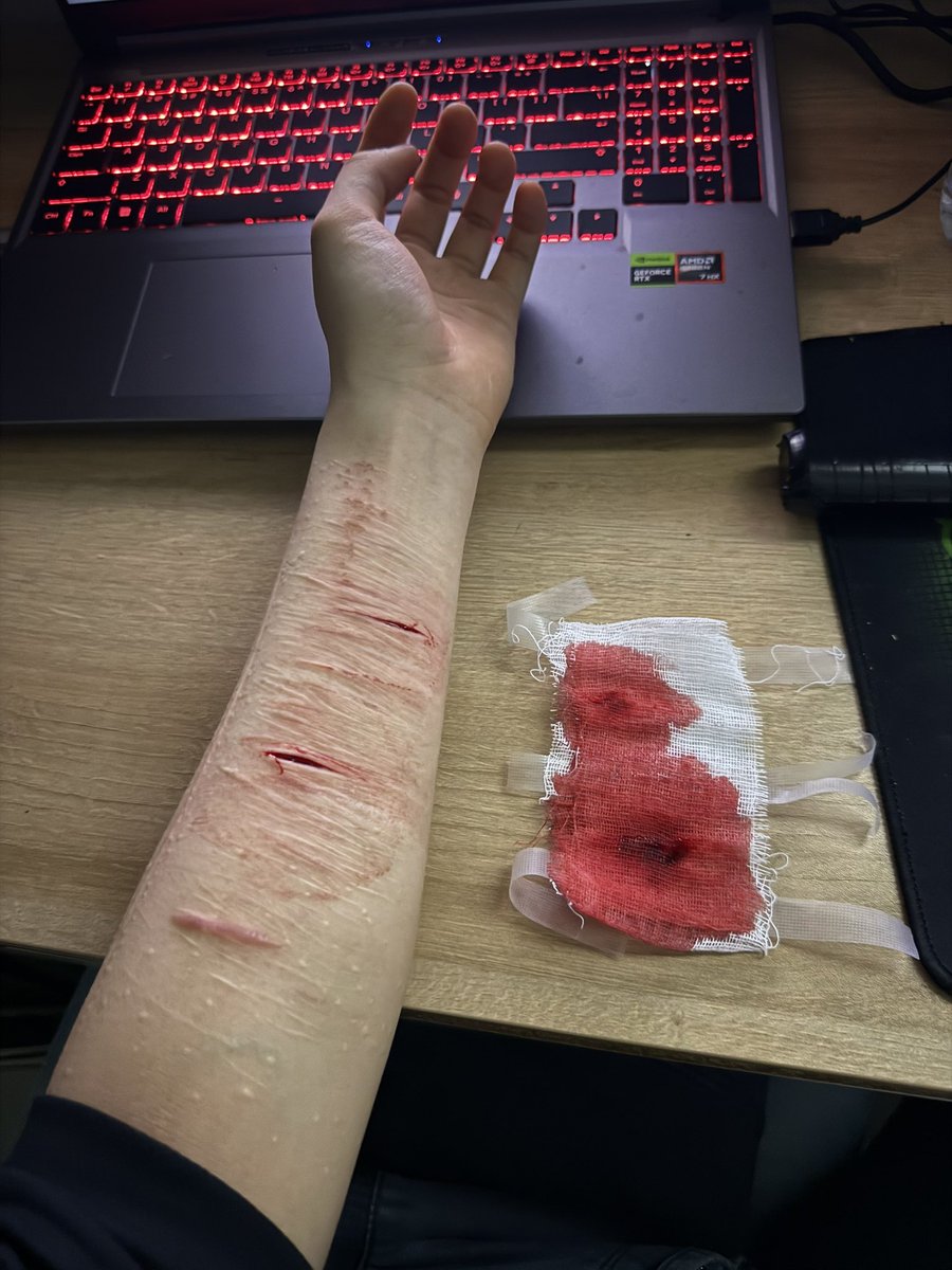 7538612joy's tweet photo. #specialeffect #specialmakeup #makeup #sfx #fake https://t.co/WbZvfksEBN